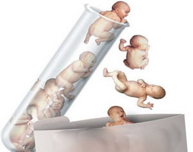 体外受精 IVF-ET